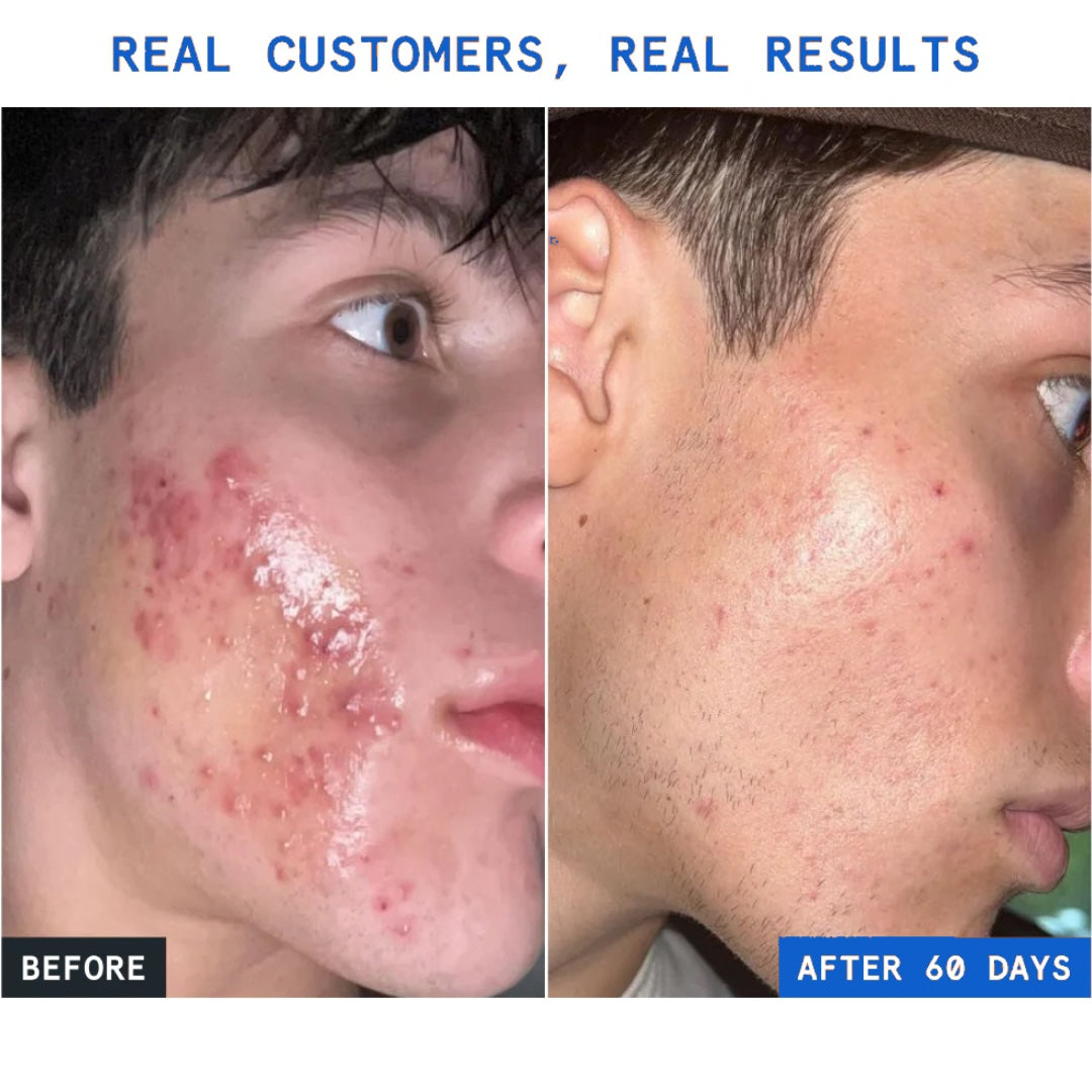 Before and after results